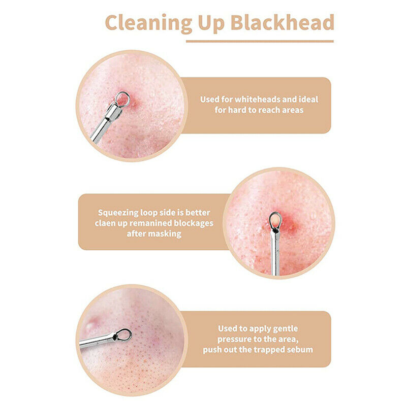 Pimple acne Black head Remover Kit
