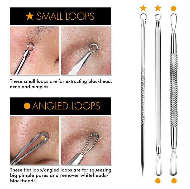 Pimple acne Black head Remover Kit