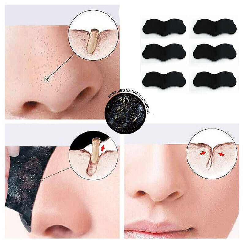 10x Deep Cleansing Nose Strips