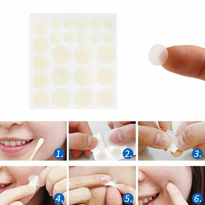 48 PCS Skin Tag & Acne Patch