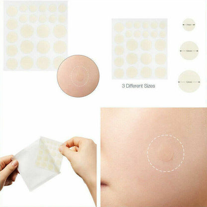 48 PCS Skin Tag & Acne Patch