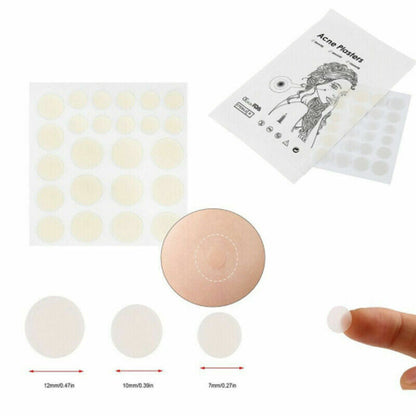 48 PCS Skin Tag & Acne Patch